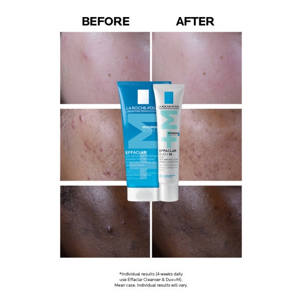 La Roche-Posay Effaclar Duo+M Anti-Breakout Corrective Gel Moisturiser