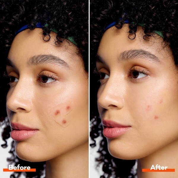 Bioré Invisible Liquid Spot Patch 15g