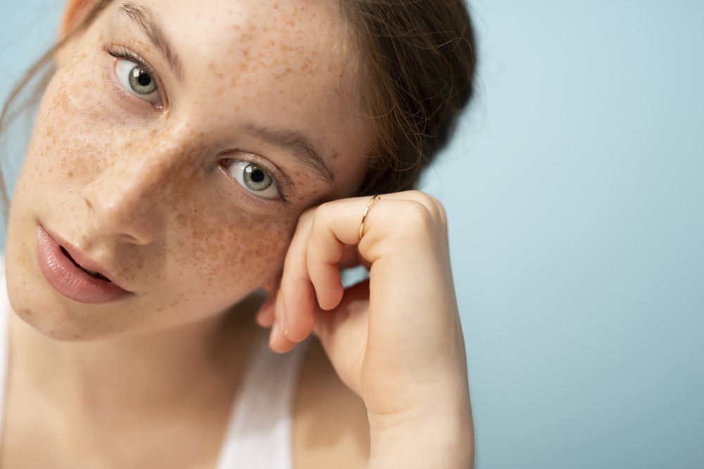 Young, fair skinned lady with freckles in a white vest